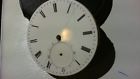 Delolme Pocket Watch Balance Is Does Not It Rare Movement