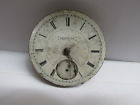 Mc435 Size Vintage Movement Watch Pocket Ill Road Mm Jewels Peoria 46 15 Service